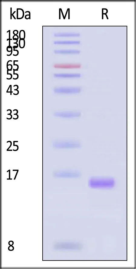 GMP Human IL-2 Protein - image 1